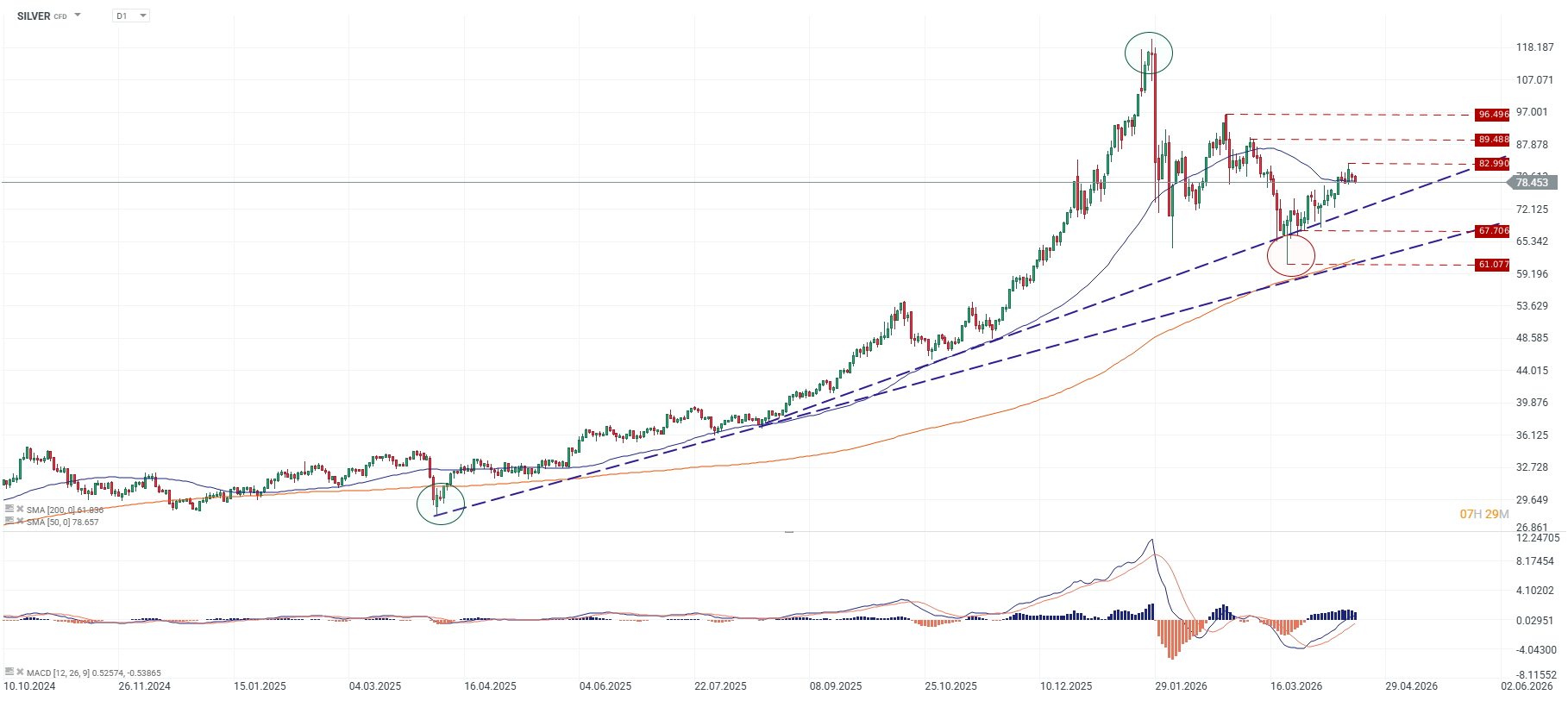 Grafico diario de la plata